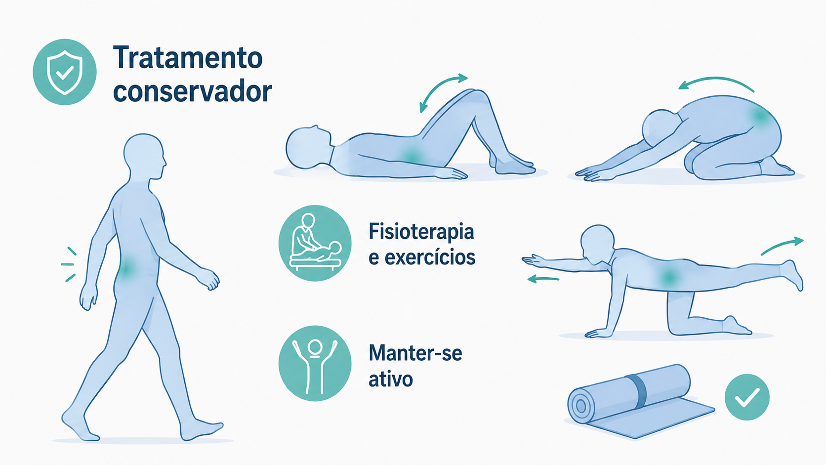Ilustração de tratamento conservador da dor lombar, com exercícios e fisioterapia.