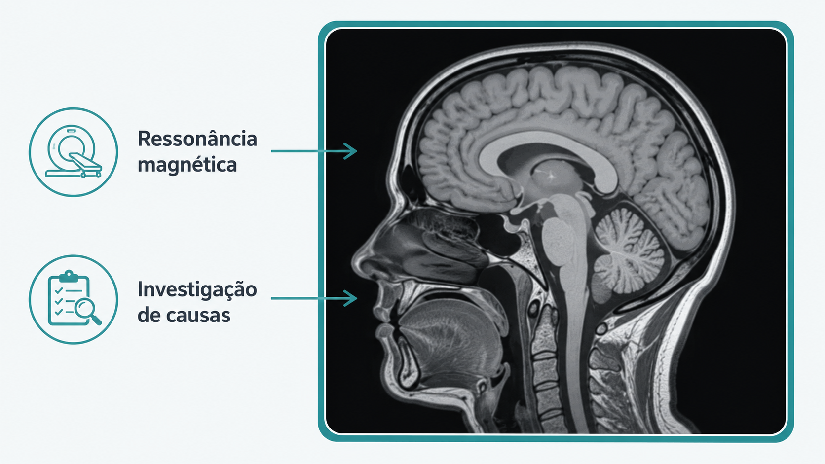 Ressonância magnética do crânio usada na investigação da dor de cabeça.