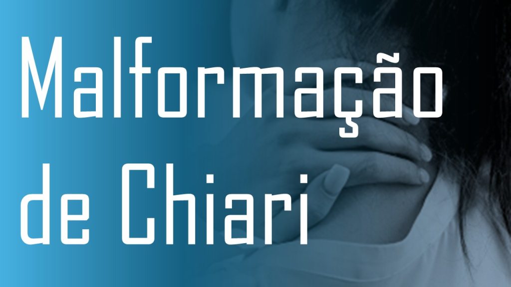 Malformação de Chiari