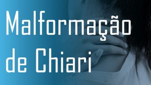 Malformação de Chiari