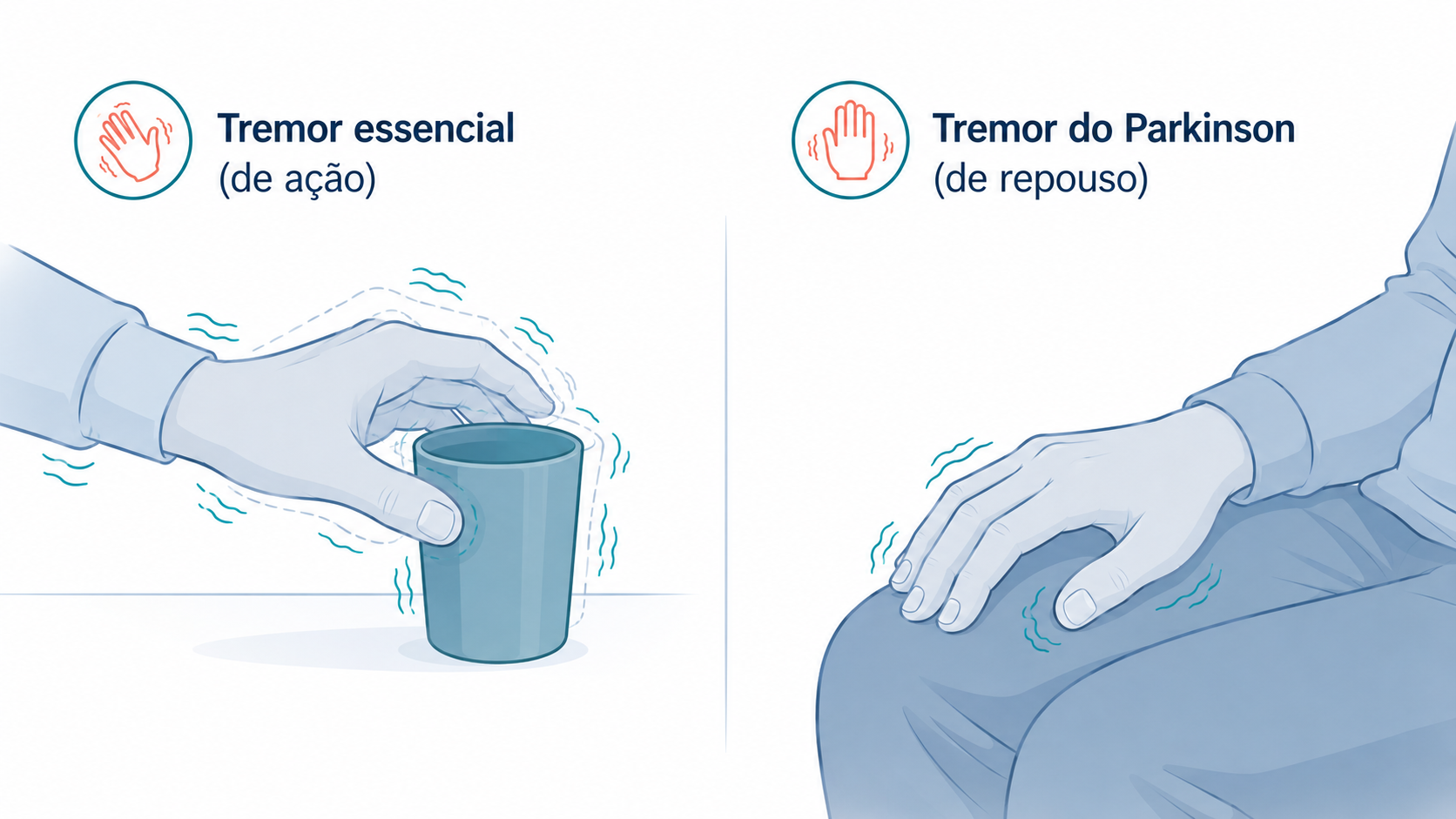 Ilustração comparando o tremor essencial, de ação, e o tremor do Parkinson, de repouso.