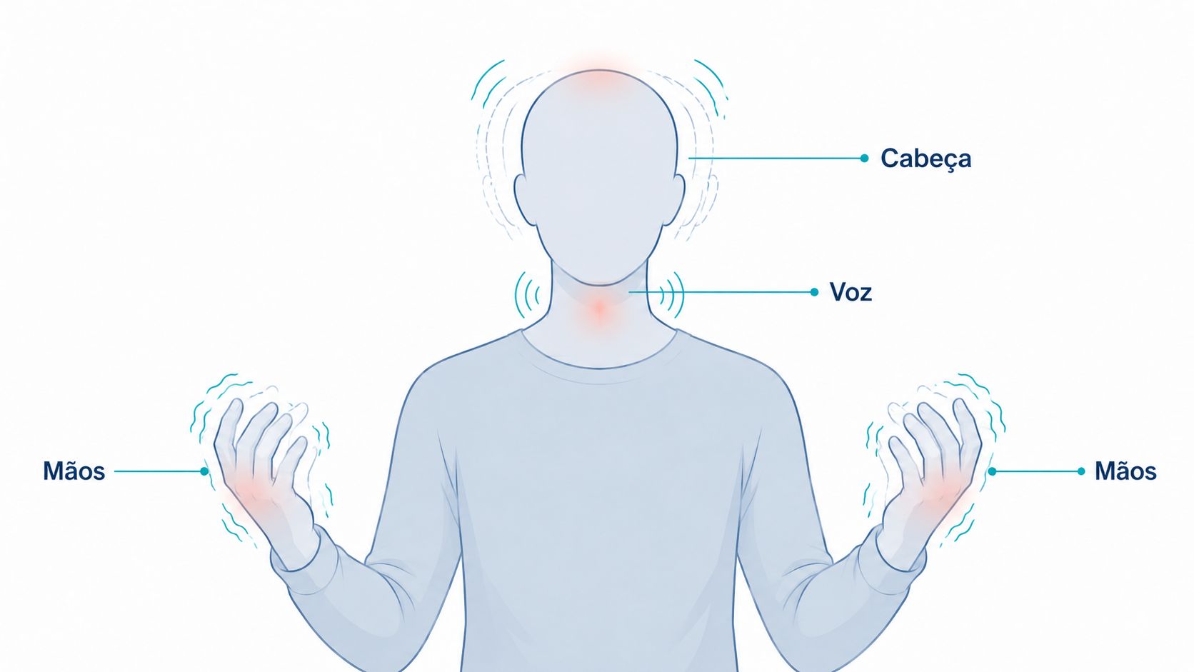 Ilustração das partes afetadas pelo tremor essencial: mãos, cabeça e voz.