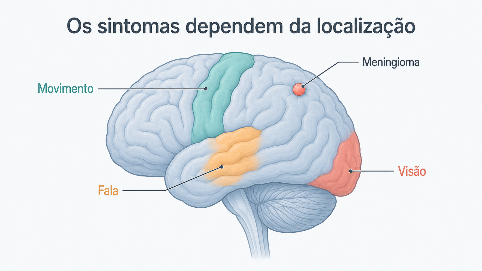 Ilustração do cérebro com áreas de movimento, fala e visão.